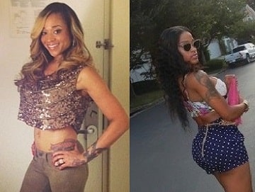 A before and after picture of Mimi Faust's plastic surgery.